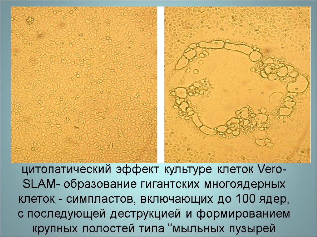 цитопатический эффект культуре клеток Vero-SLAM- образование гигантских многоядерных клеток - симпластов, включающих до 100